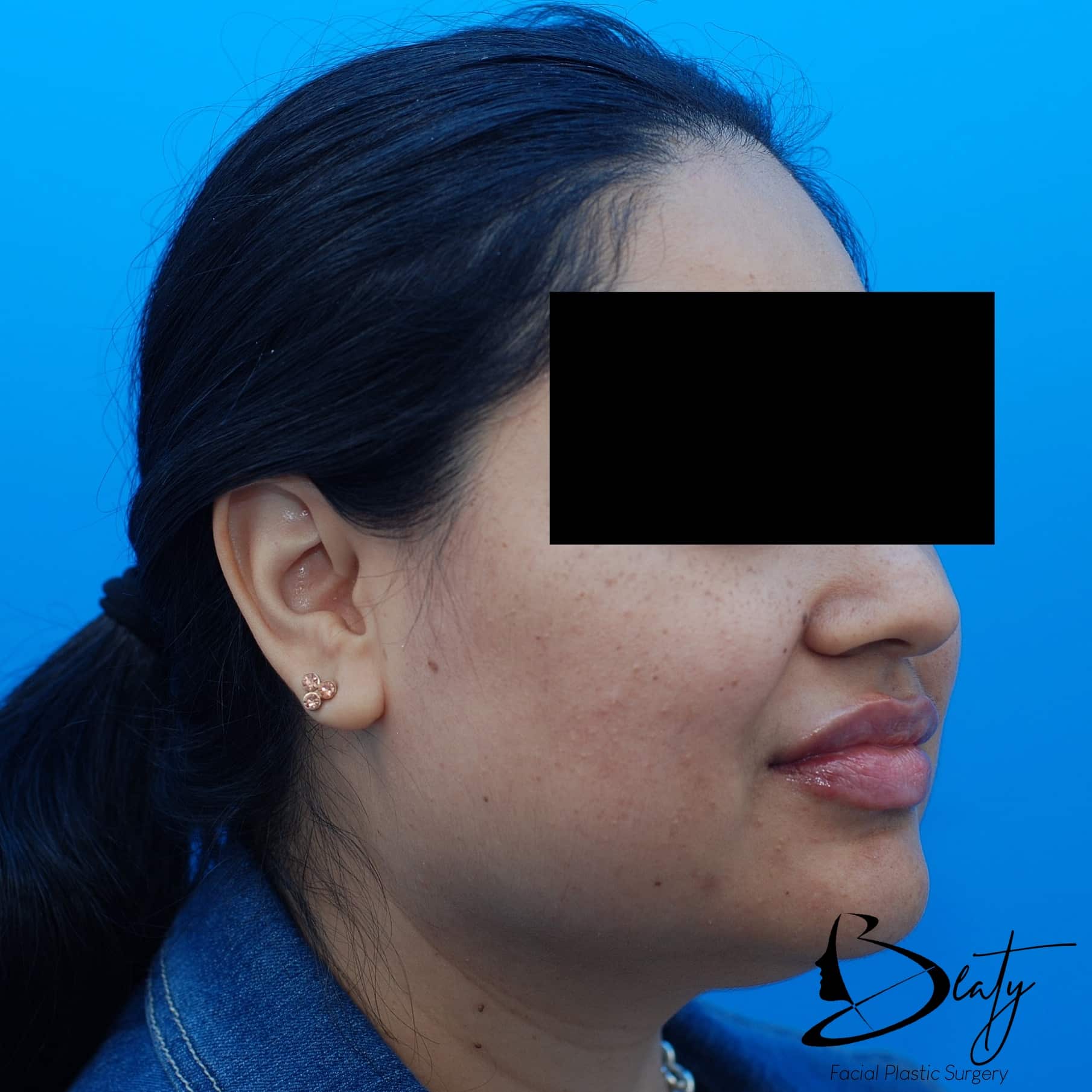 After Image