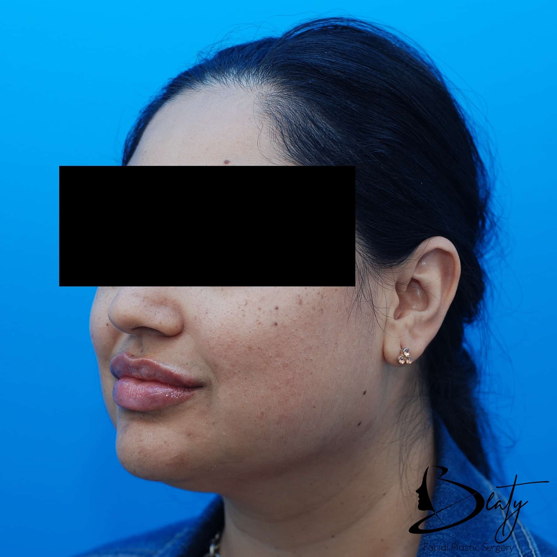 After Image
