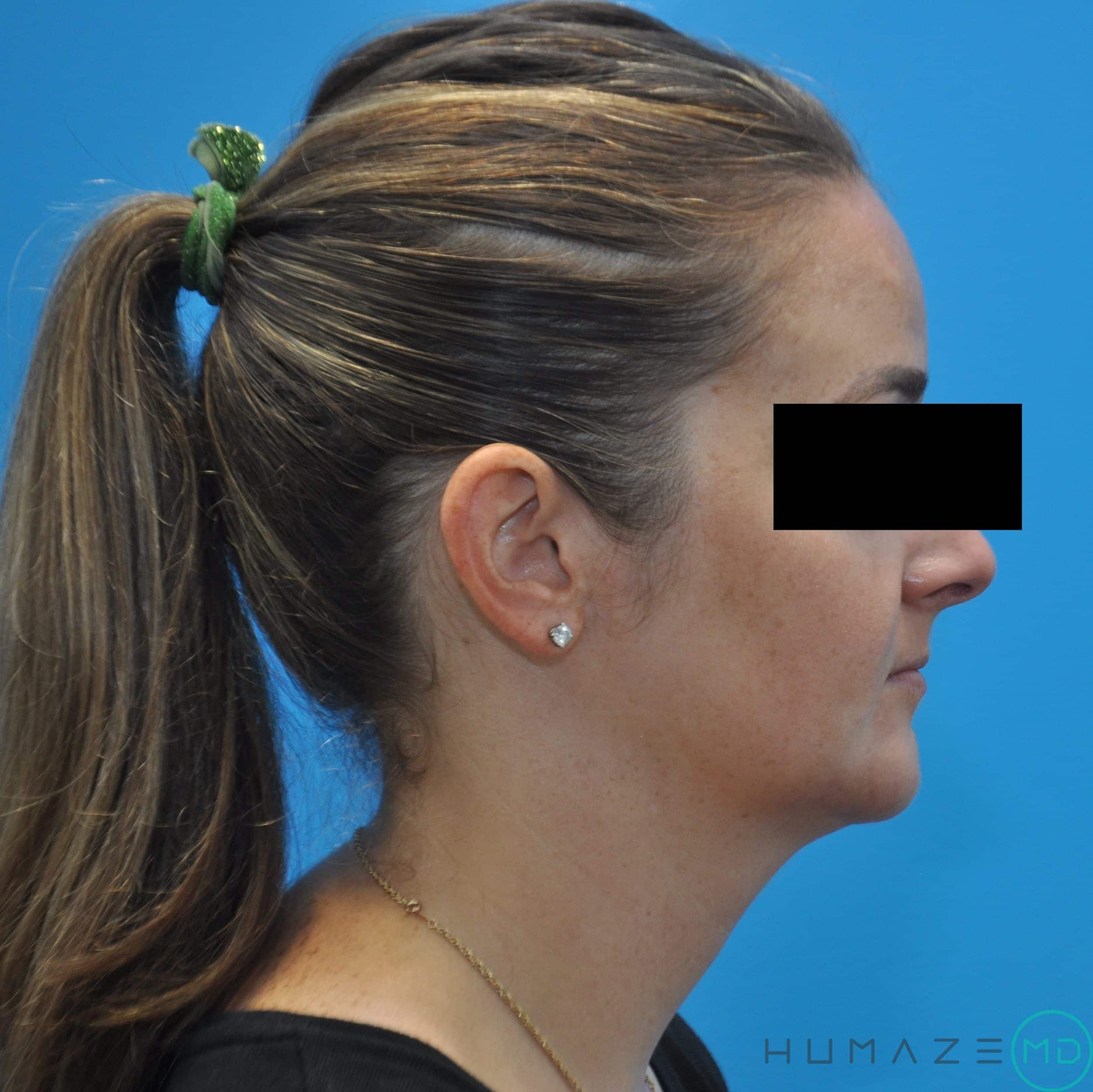 After Image