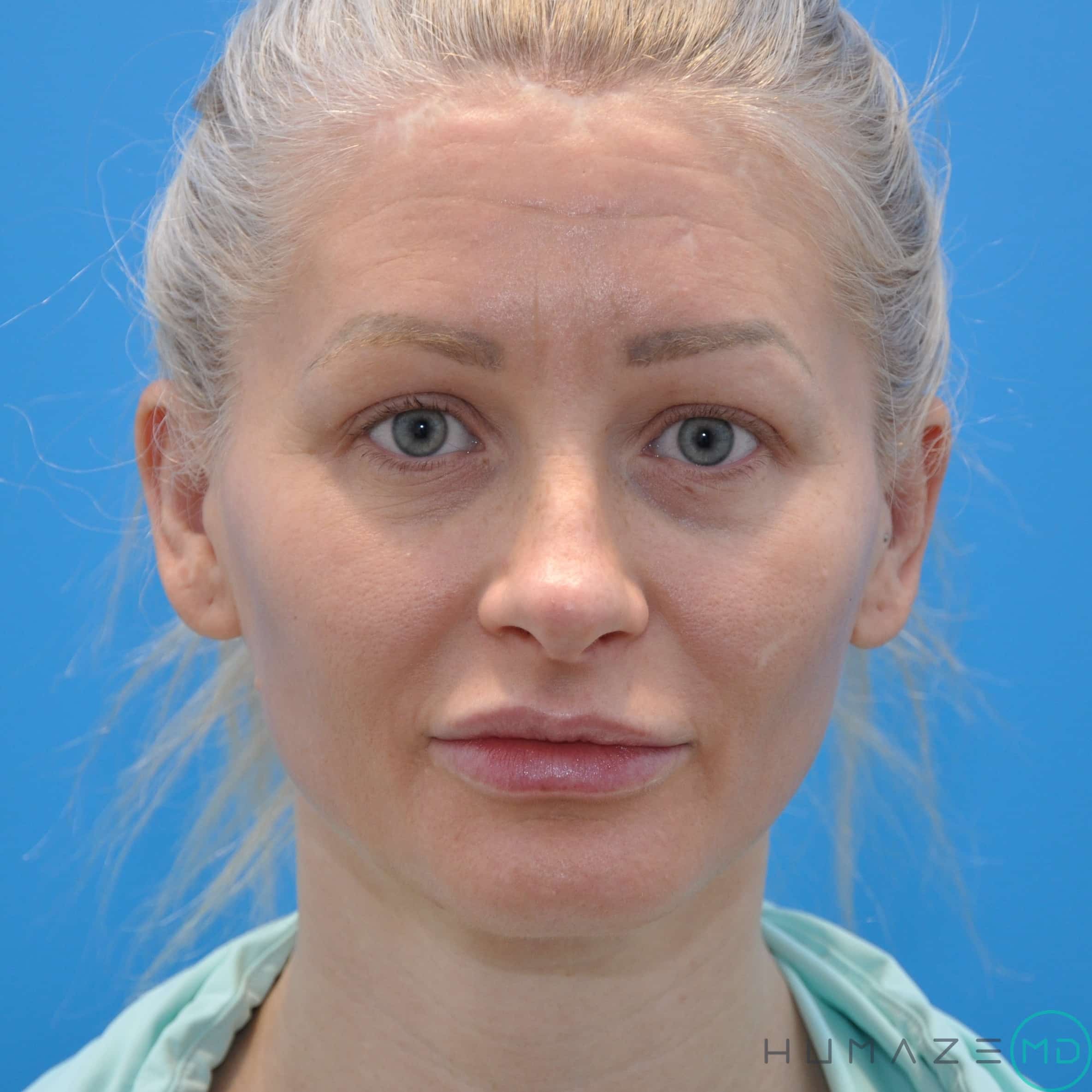 After Image