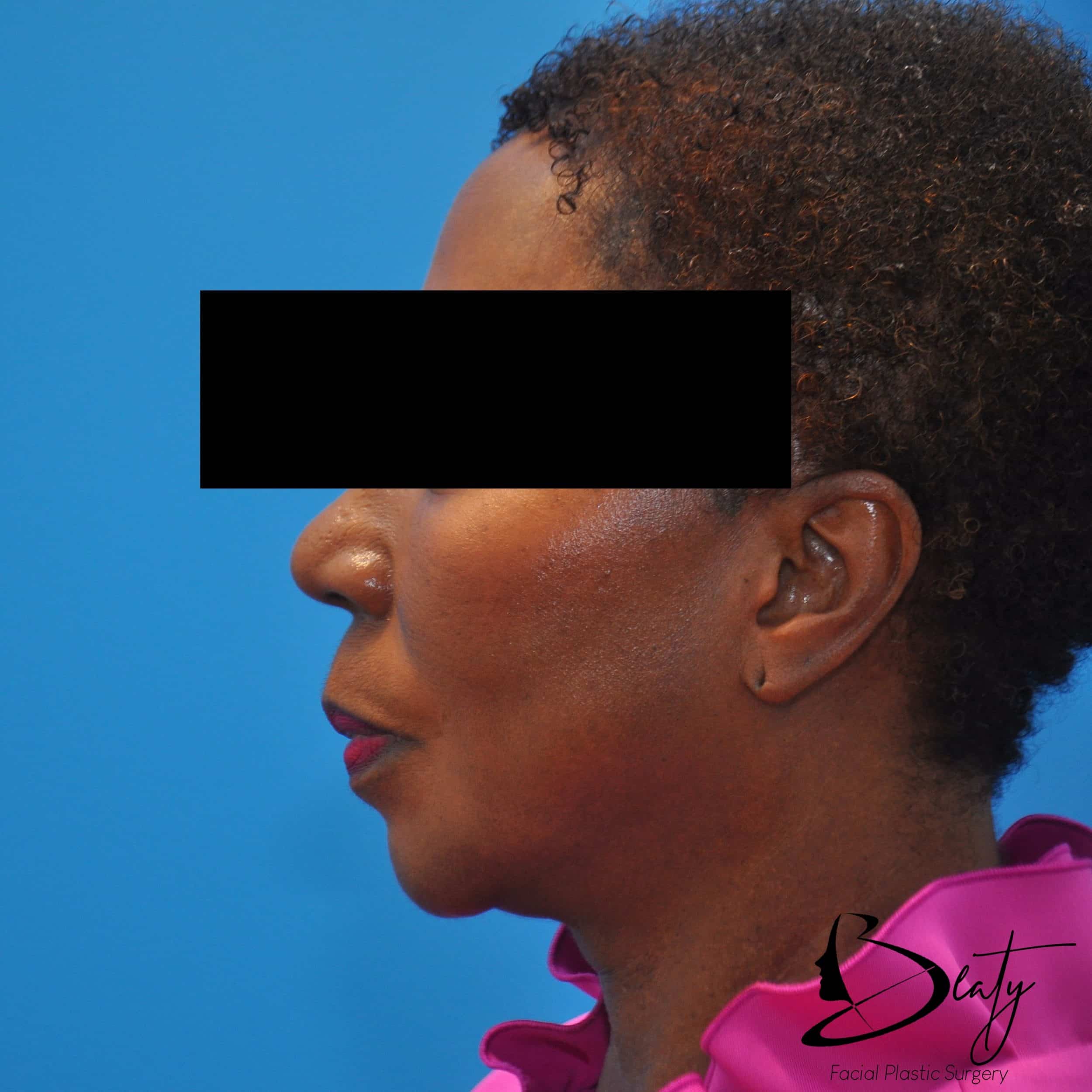 After Image