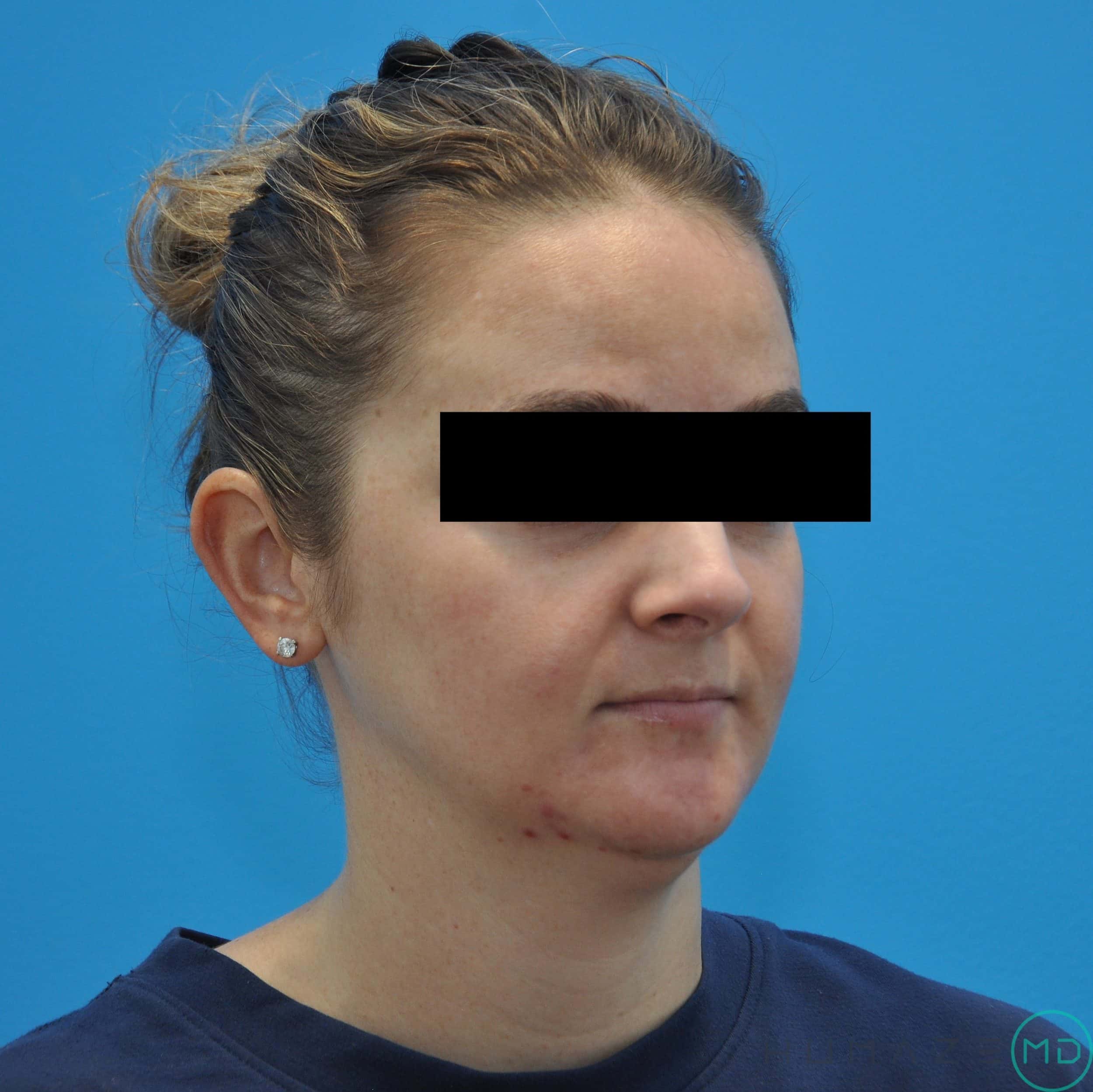 Before Image
