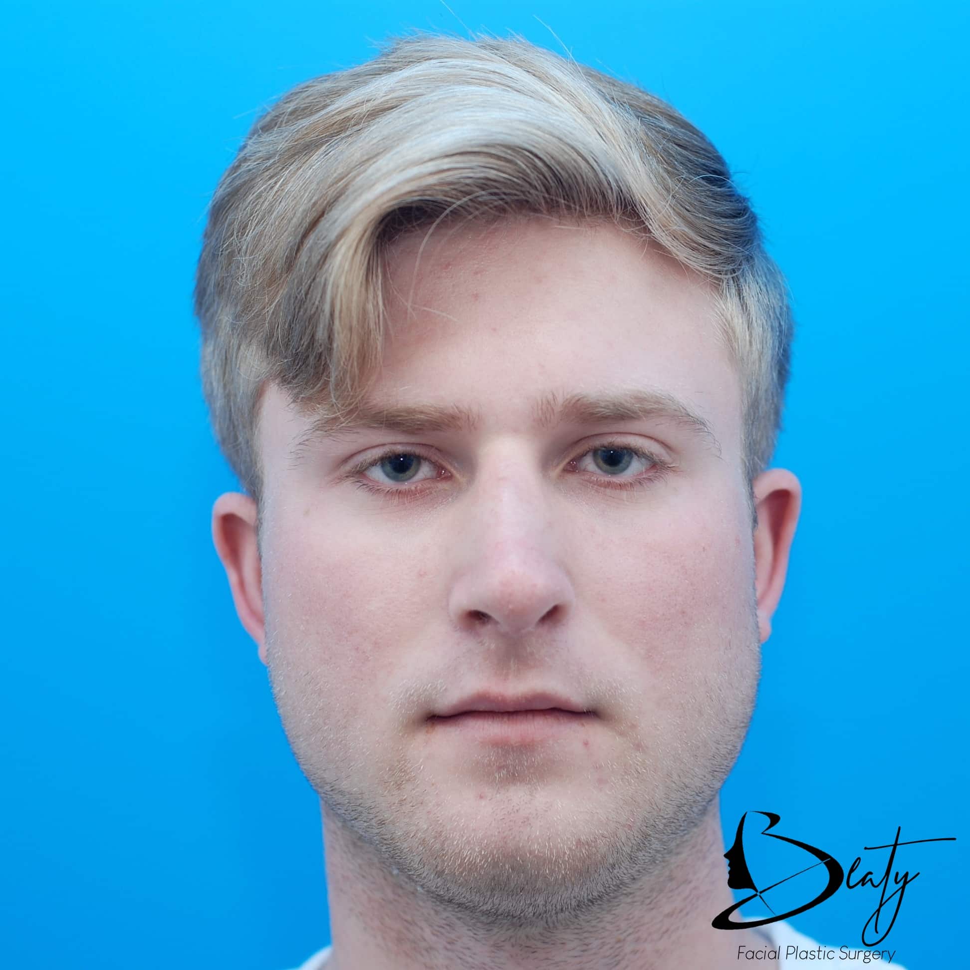 After Image