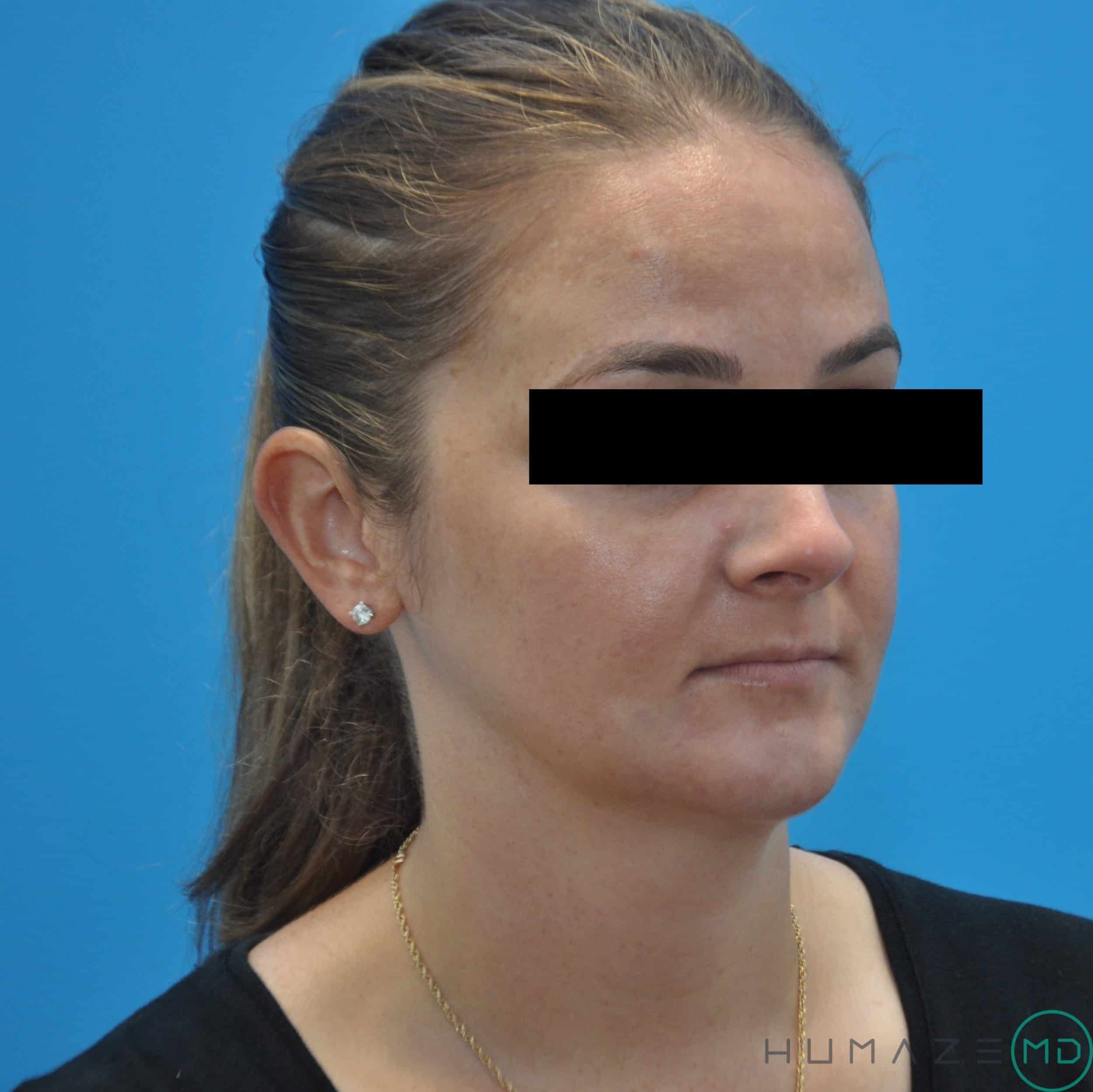 After Image