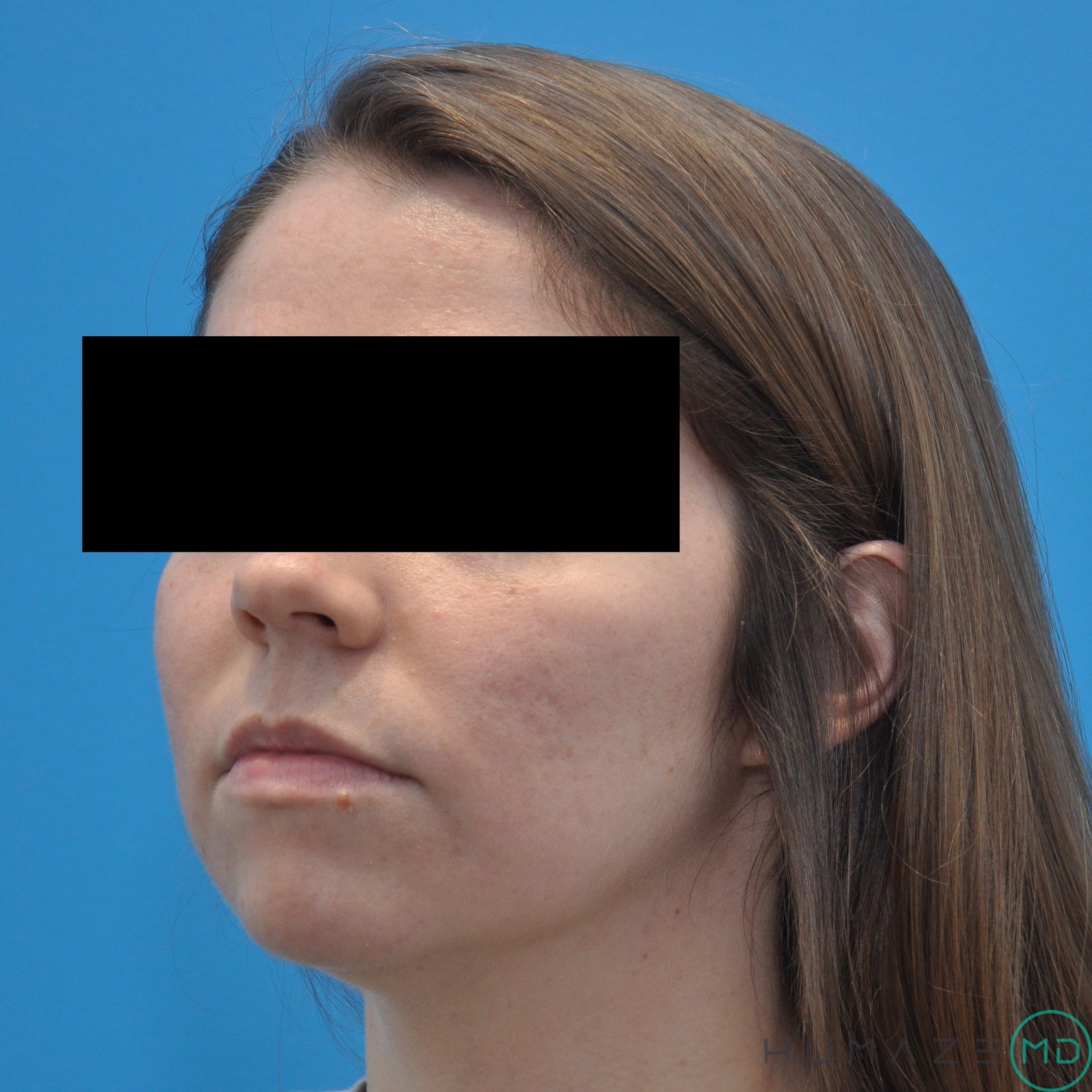 Before Image