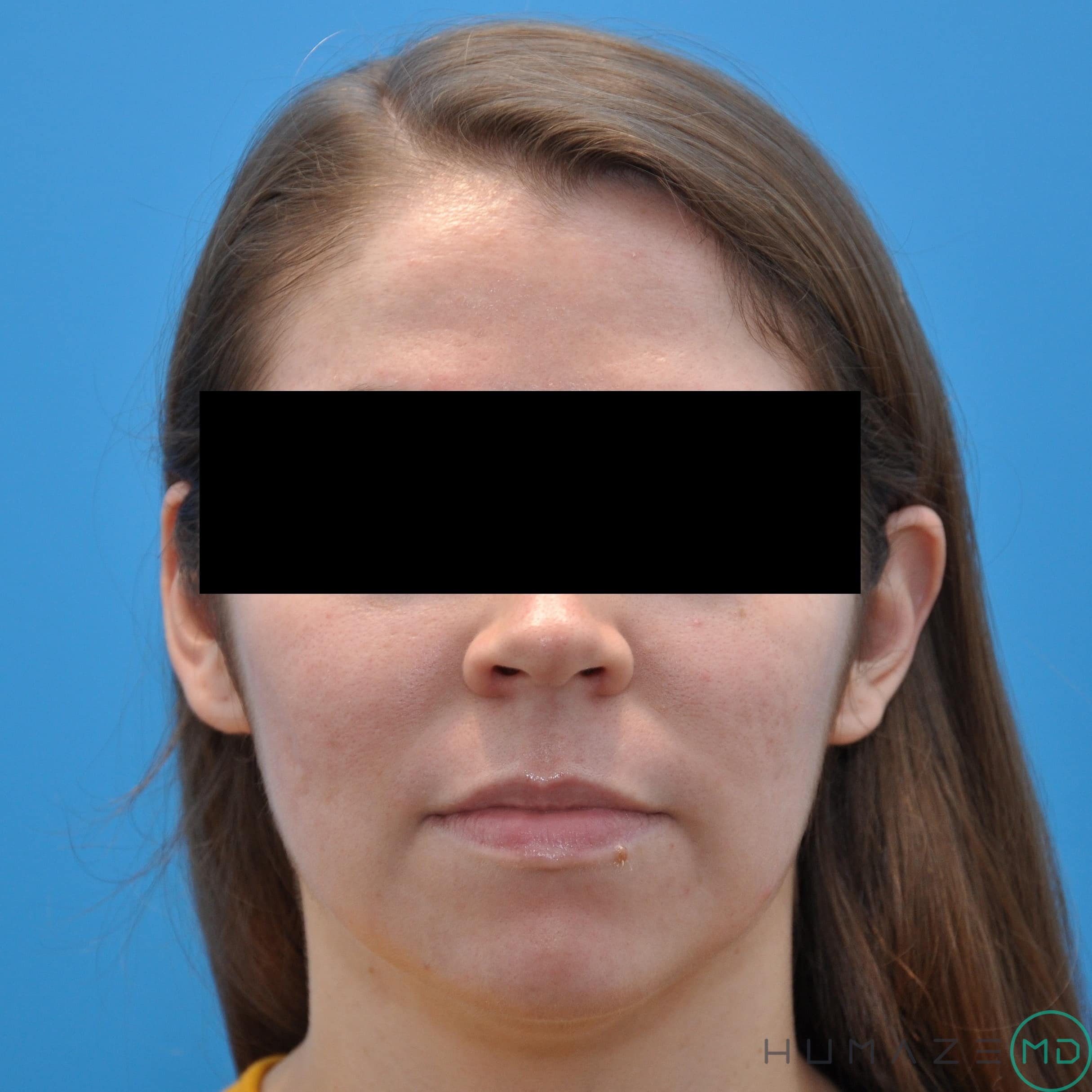 After Image