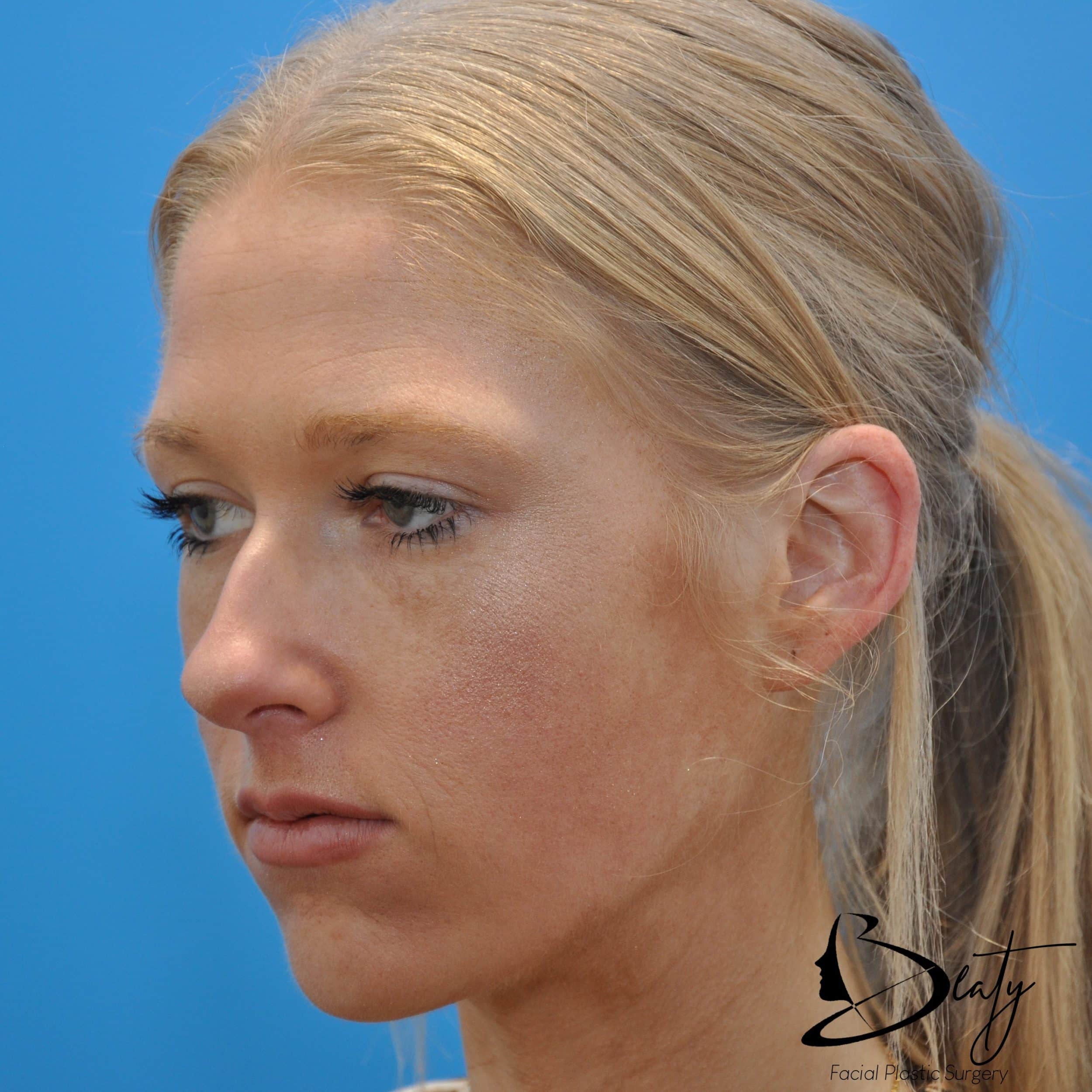 After Image