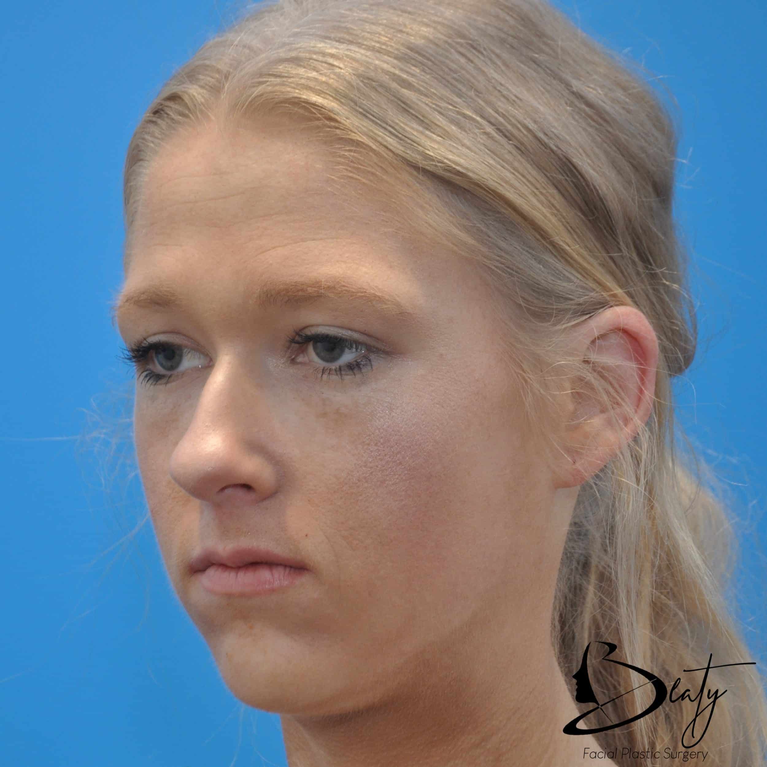 Before Image