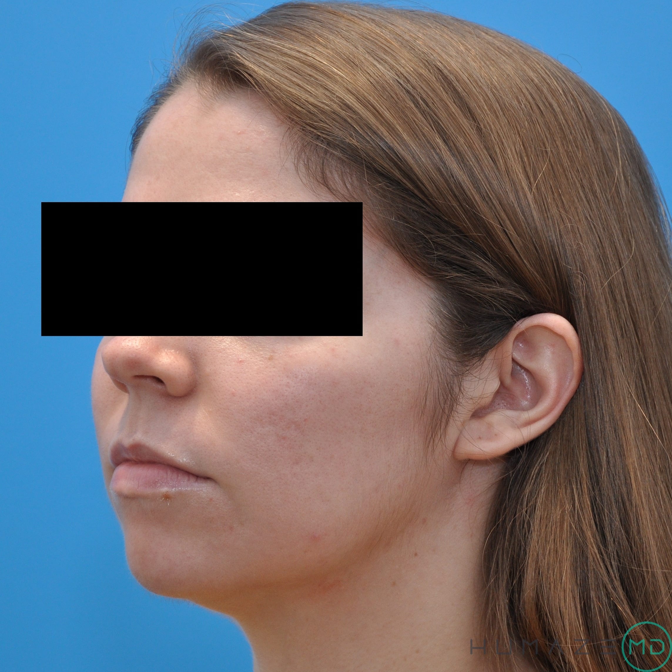 After Image