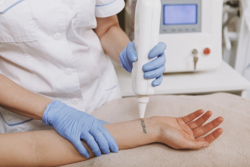 Professional dermatologist using laser removing tattoo on the skin of female client