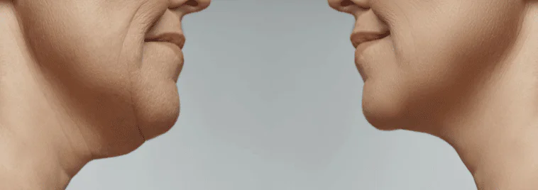 Untitled design 3
