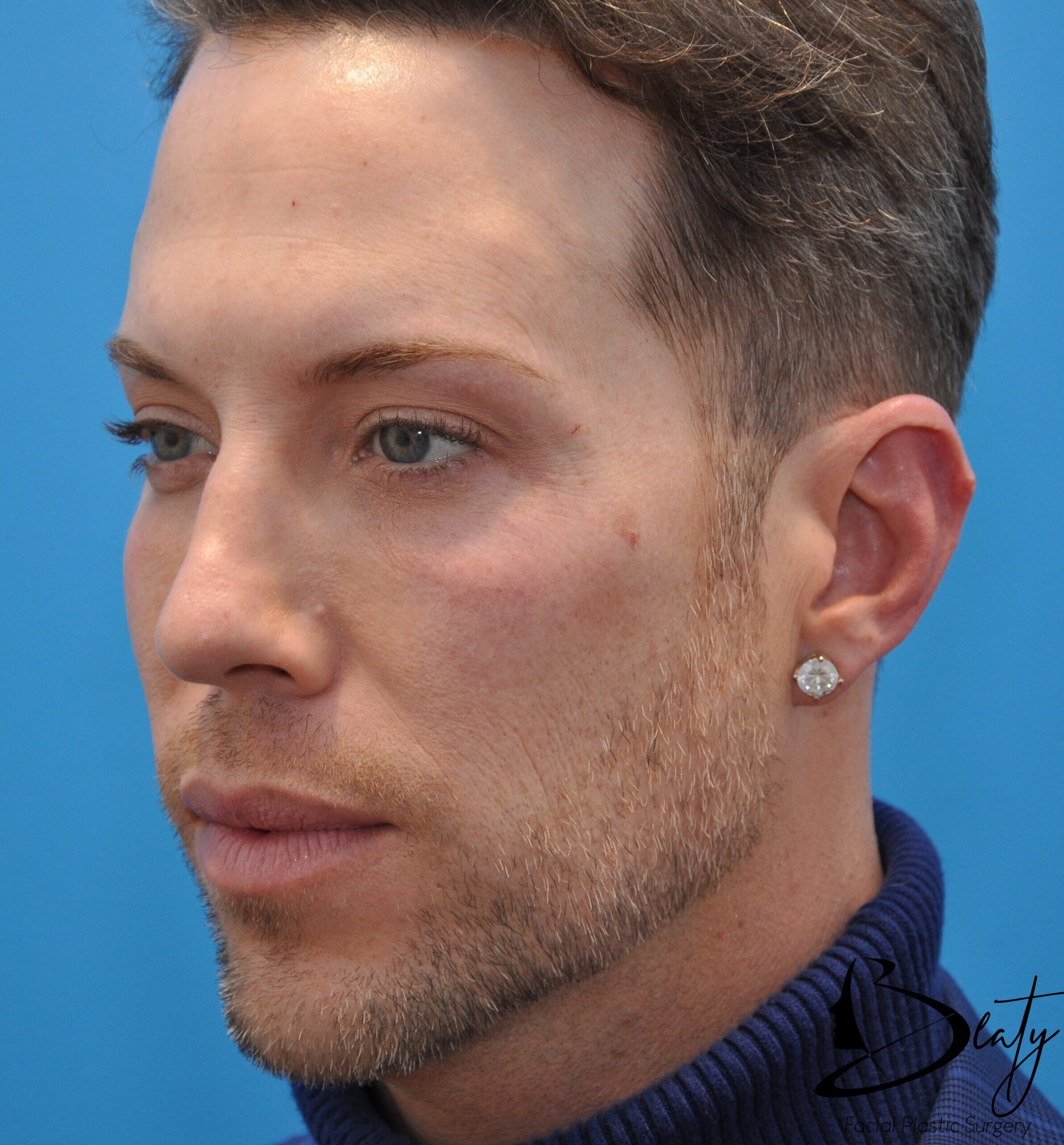 After Image