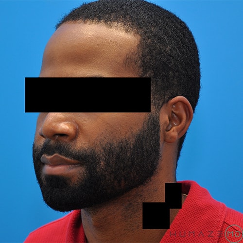 Before Image