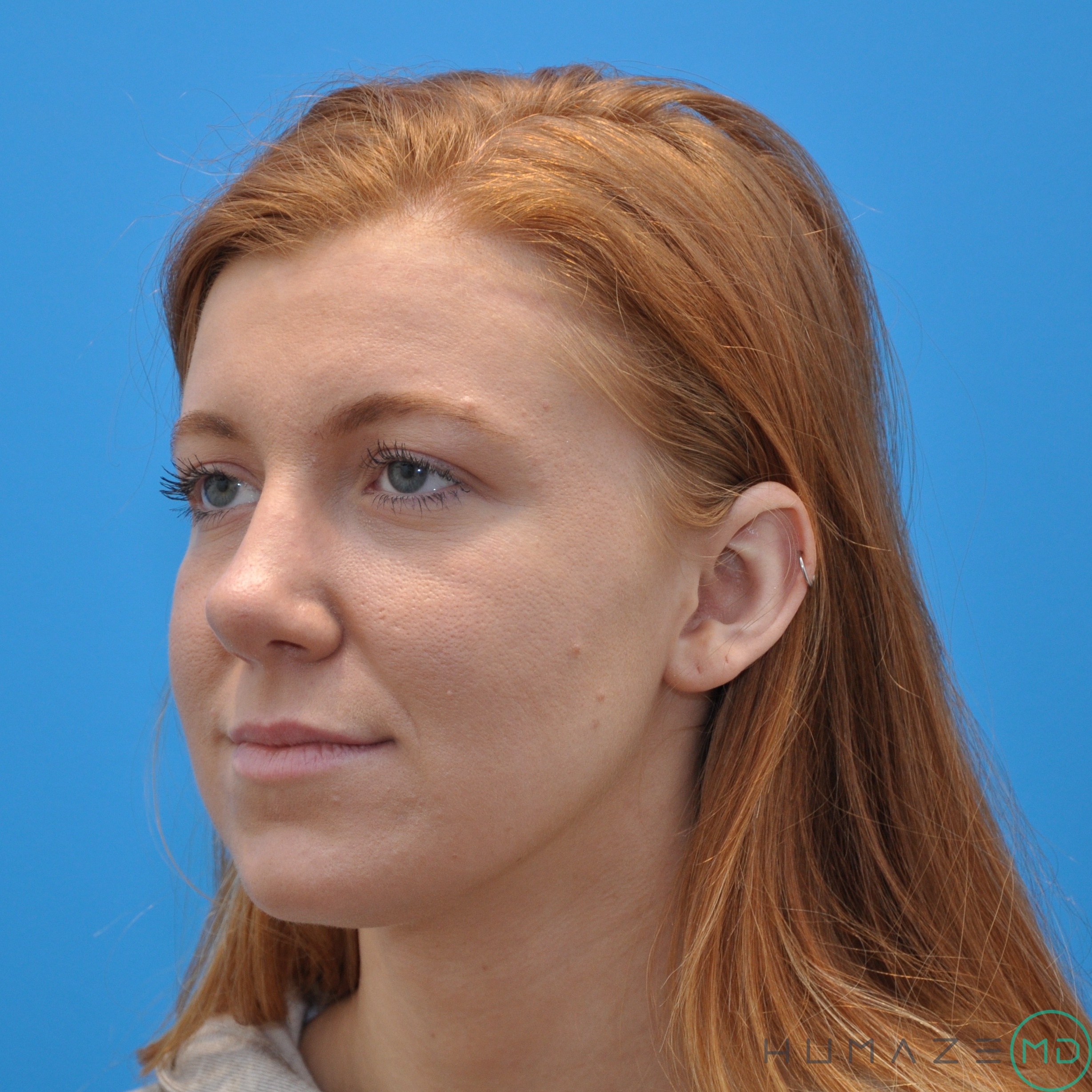 After Image