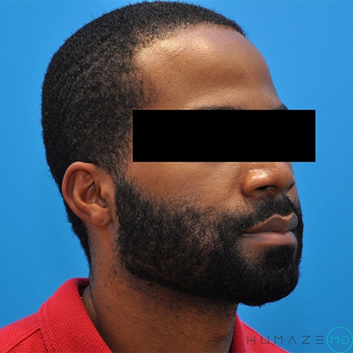 Before Image