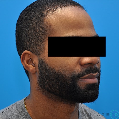 After Image