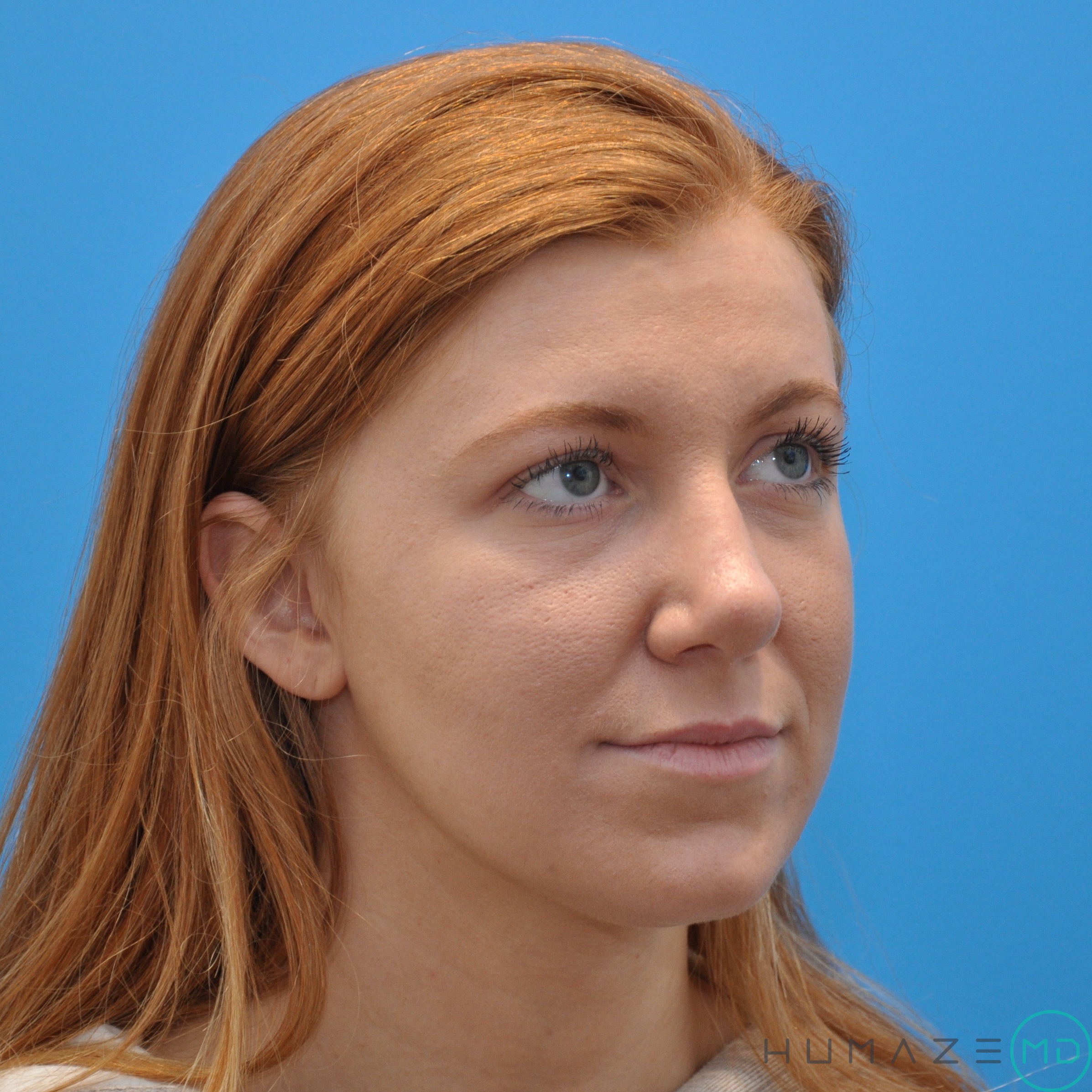 After Image