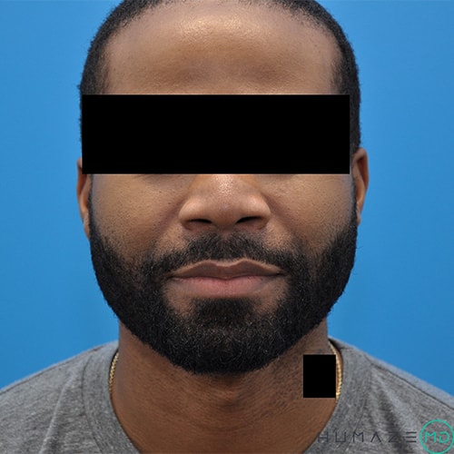 After Image