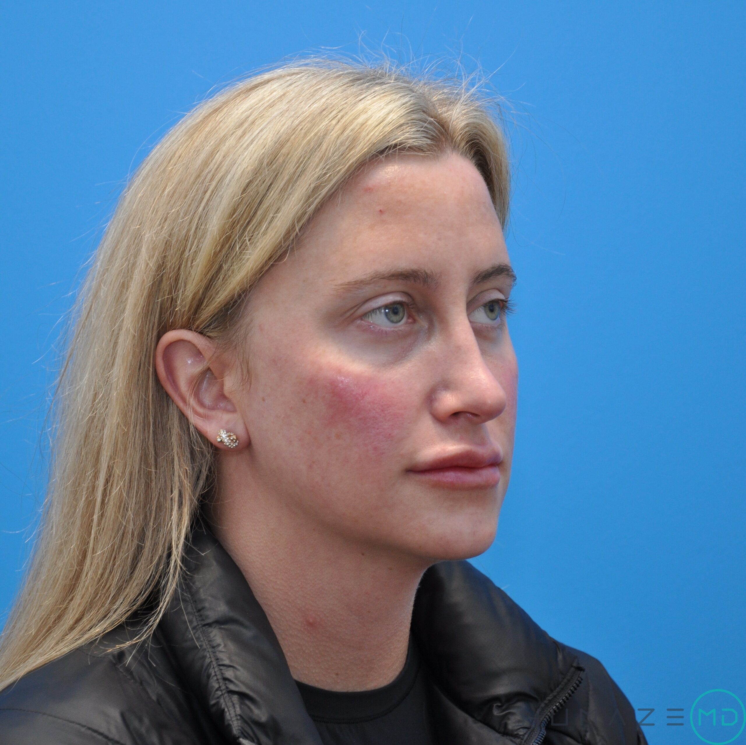 After Image