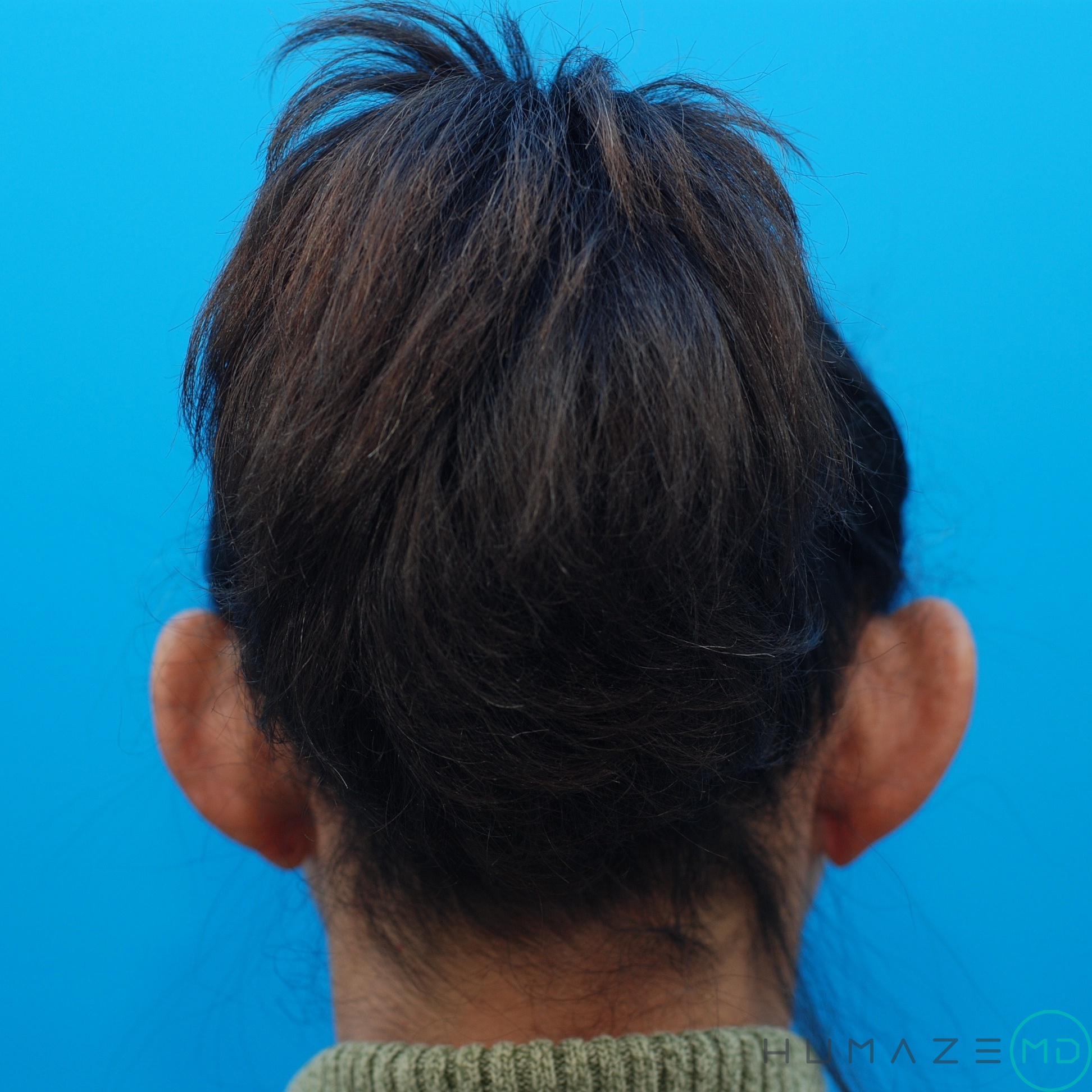 Before Image