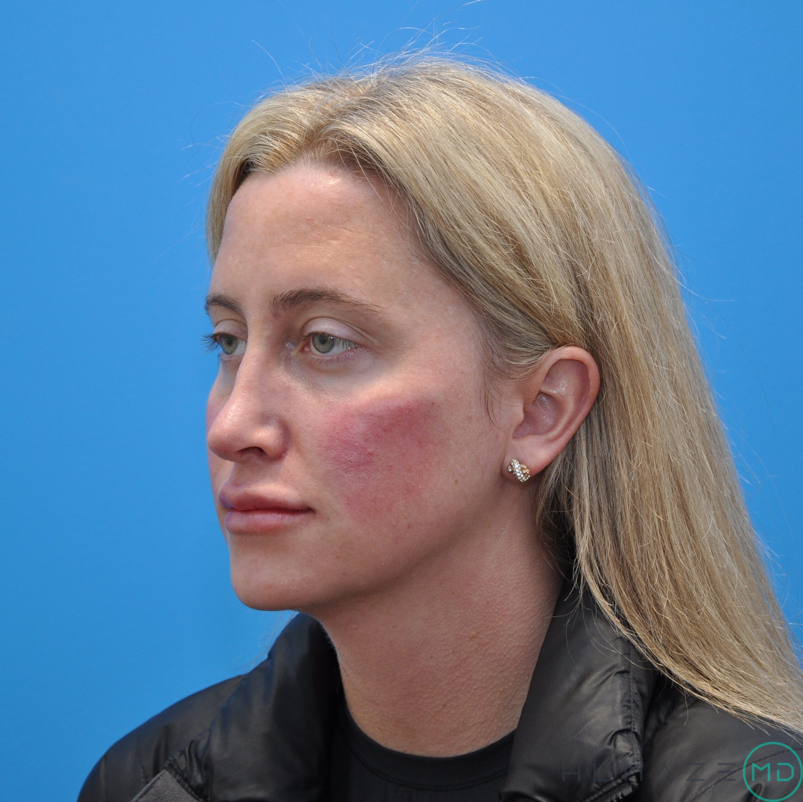 After Image