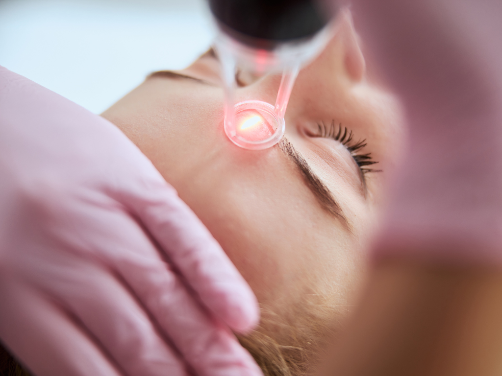 laser radiofrequency energy assisted device skin resurfacing
