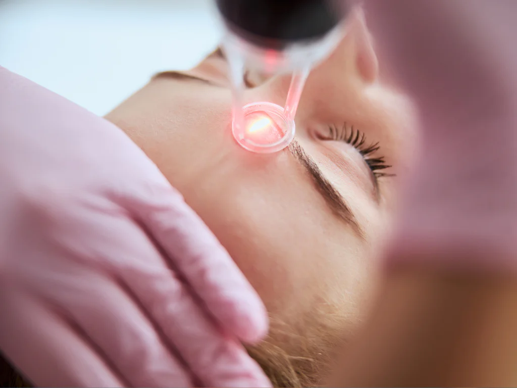 laser treatment