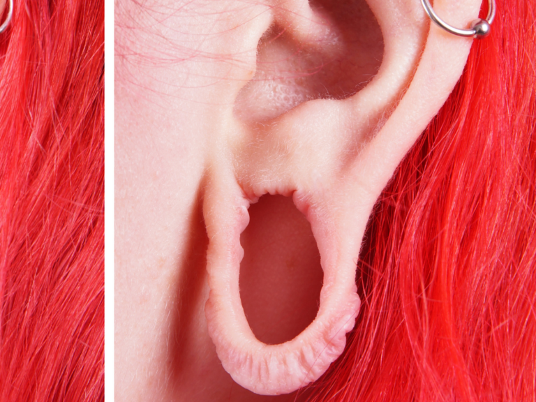 Post Thumbnail