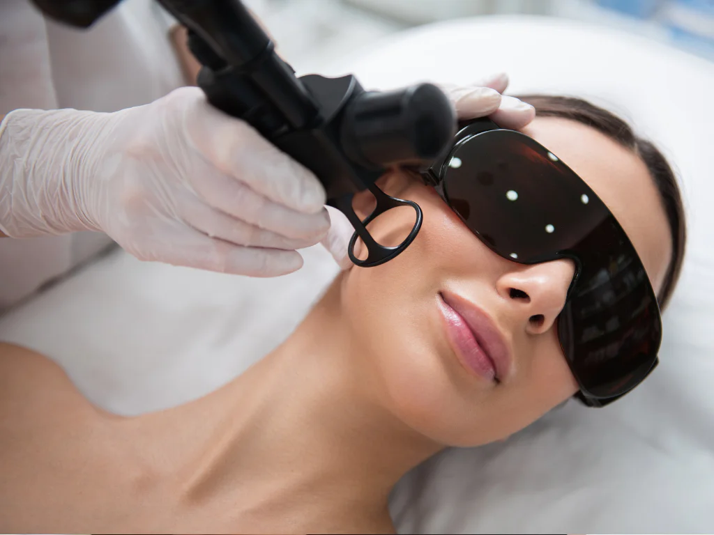 laser skin resurfacing 101