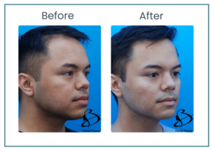 Beaty featured BA template 1