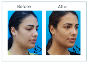 Beaty featured BA template