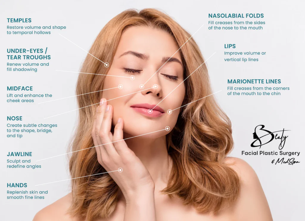 Dermal Filler Infographic