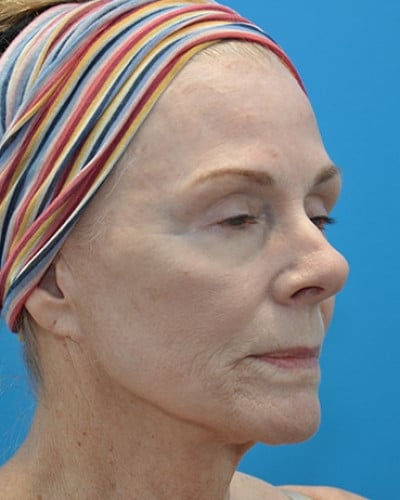 After Image