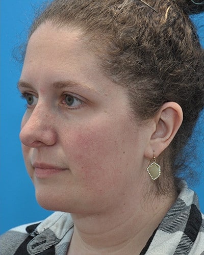 After Image