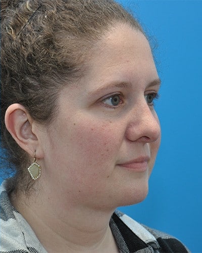 After Image