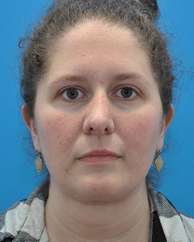 After Image