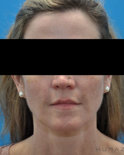 After Image