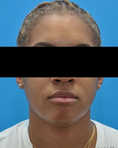 After Image