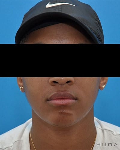 Before Image