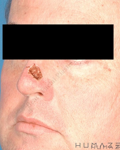 Before Image