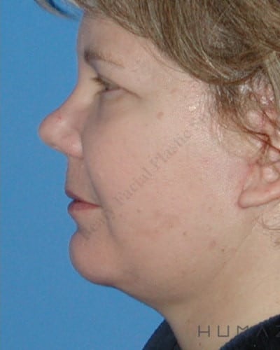 After Image