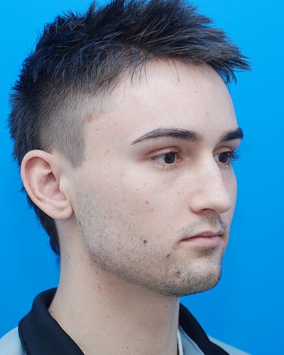 After Image