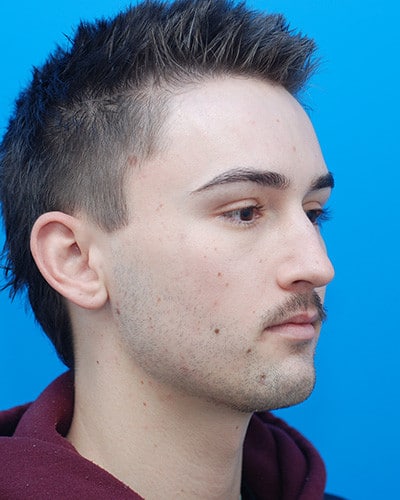 Before Image
