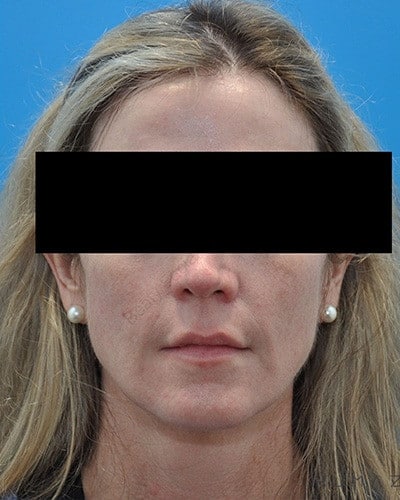 After Image