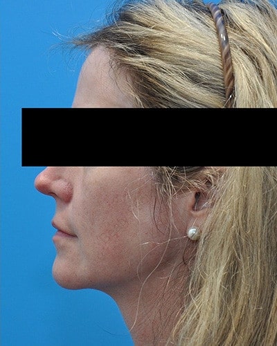 After Image