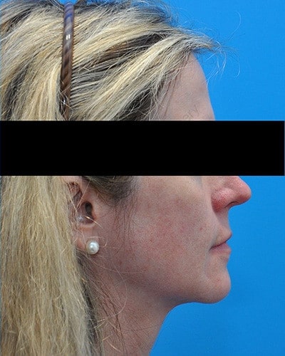 After Image