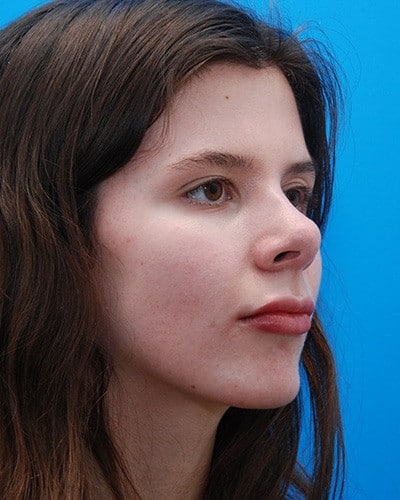 After Image