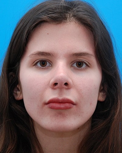 After Image