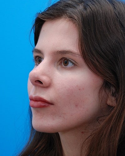 After Image