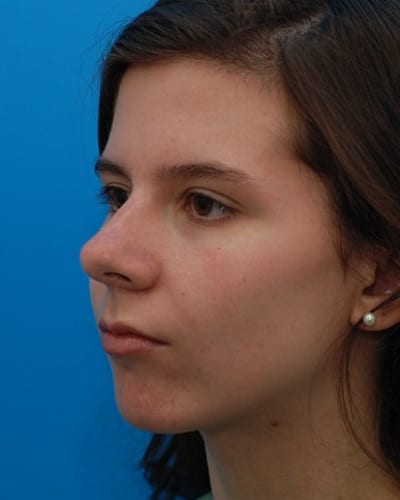 Before Image